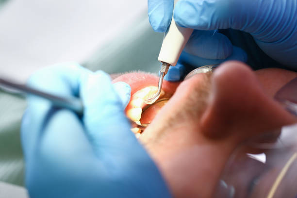 Best Emergency Cosmetic Dentistry (e.g., broken veneers) in Warner, OK